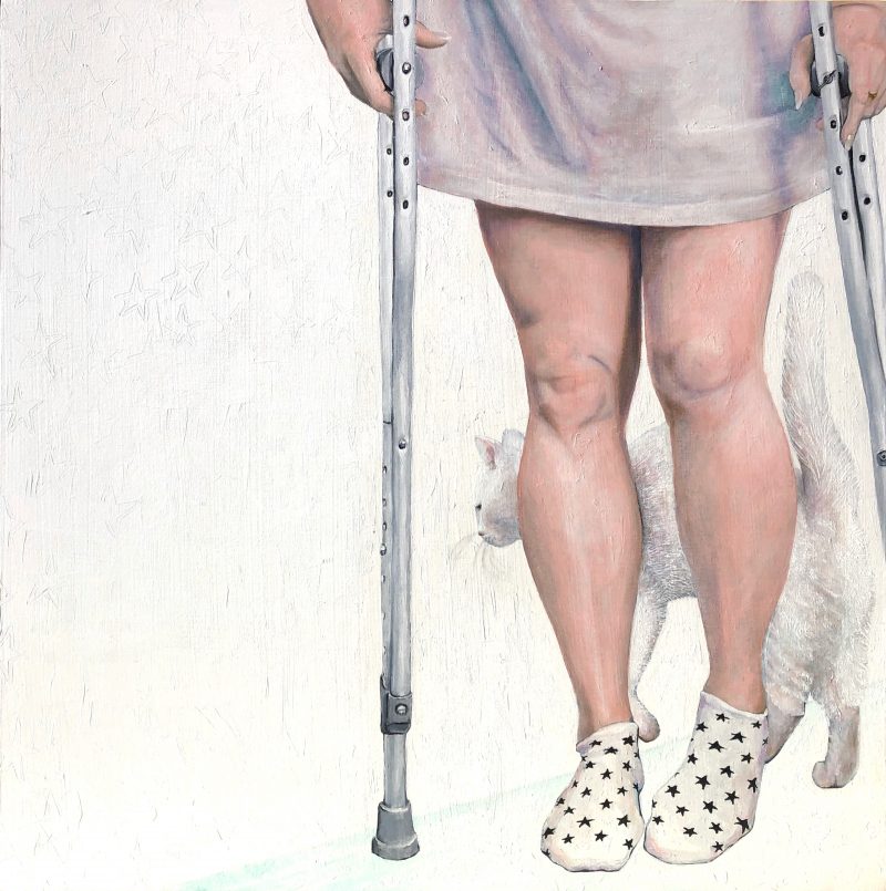 Painting of a woman on crutches walking with a cat behind her. Viewpoint is from the hips down.