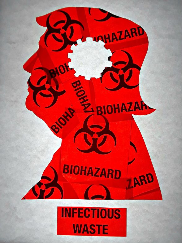 Outline of trump filled in with biohazard labels with a cog shape missing in his brain.