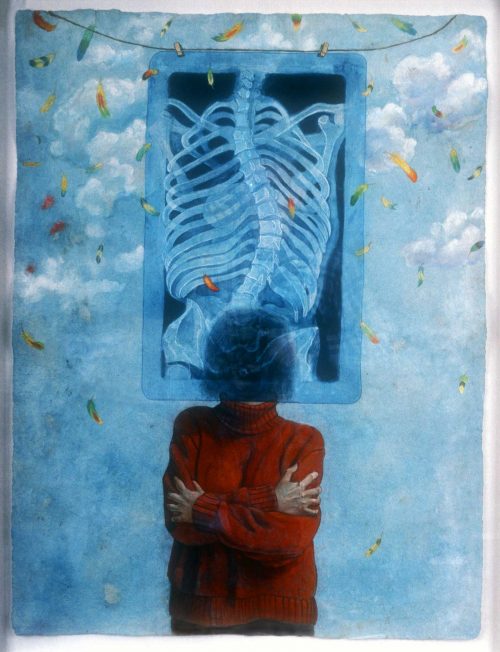 Self-portrait in gouache on paper. Riva, a white woman, is situated in the center wearing a red turtleneck sweater and crossing her arms. Her face is covered by a semi-transparent X ray film of her curved spine, pelvis, and rib cage. In the background is a blue sky with soft white clouds towards the top of the artwork. Multi-colored feathers are falling from the sky.
