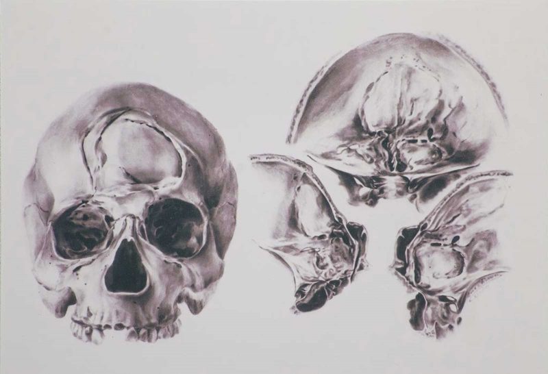 Black and white medical drawing of a human skull from two perspectives: front and back (bisected to see into the interior).