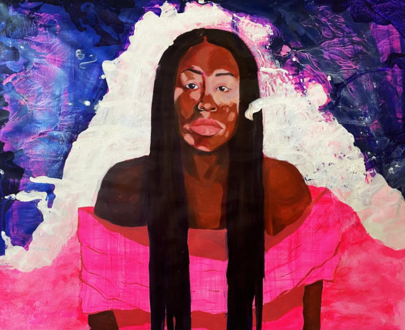 A bright-colored oil and acrylic painting shows a portrait of a somber Black woman with long braids and a face predominantly of dark skin with patches of less-pigmented skin around the eyes, nose, mouth and chin. (Vitiligo perhaps). She wears a shoulder-less fuchsia gown and stares at you questioningly.